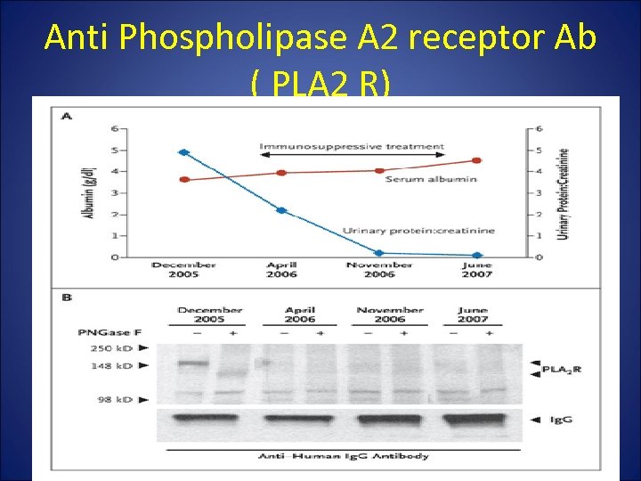 Anti Phospholipase A 2 receptor Ab ( PLA 2 R) 