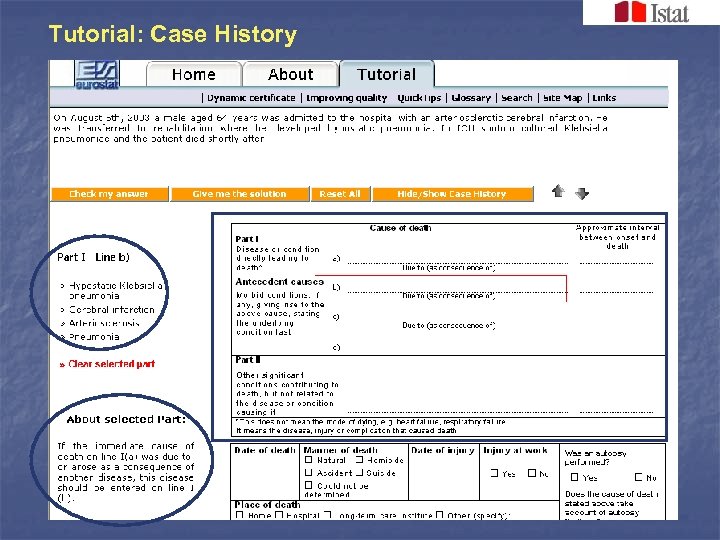 Tutorial: Case History 