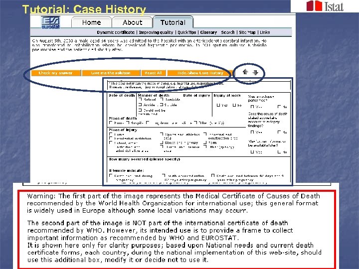 Tutorial: Case History 