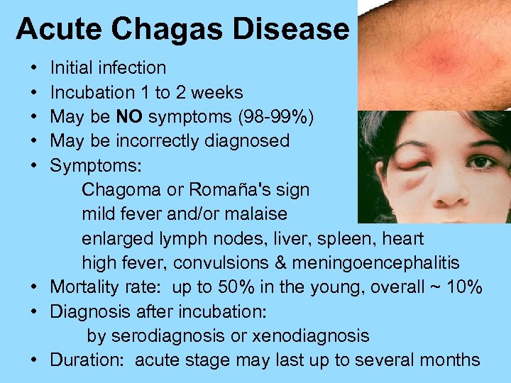 Acute Chagas Disease • • • Initial infection Incubation 1 to 2 weeks May