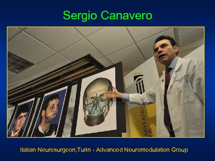 Sergio Canavero Italian Neurosurgeon, Turin - Advanced Neuromodulation Group 