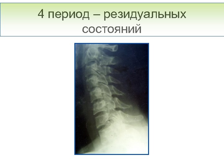 4 период – резидуальных состояний 