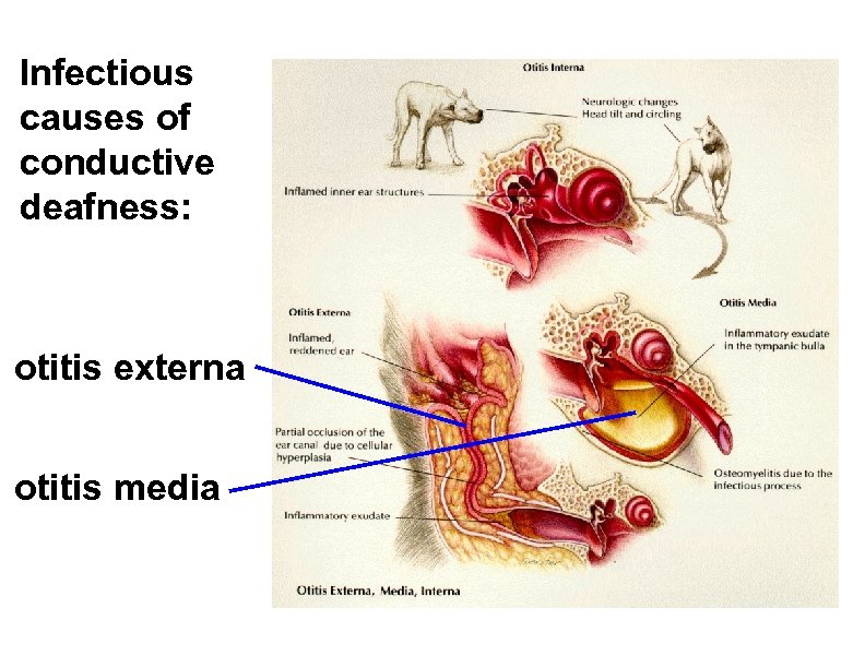 Infectious causes of conductive deafness: otitis externa otitis media 