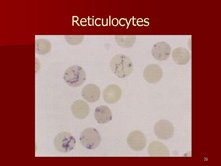 Reticulocytes 20 