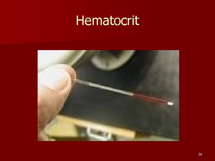 Hematocrit 34 