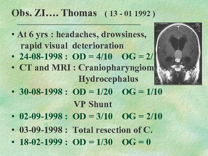 Obs. ZI…. Thomas ( 13 - 01 1992 ) • At 6 yrs :