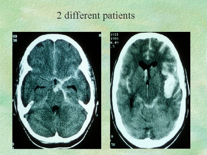 2 different patients 
