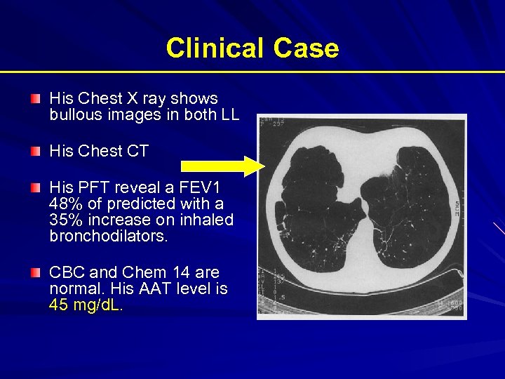 Clinical Case His Chest X ray shows bullous images in both LL His Chest