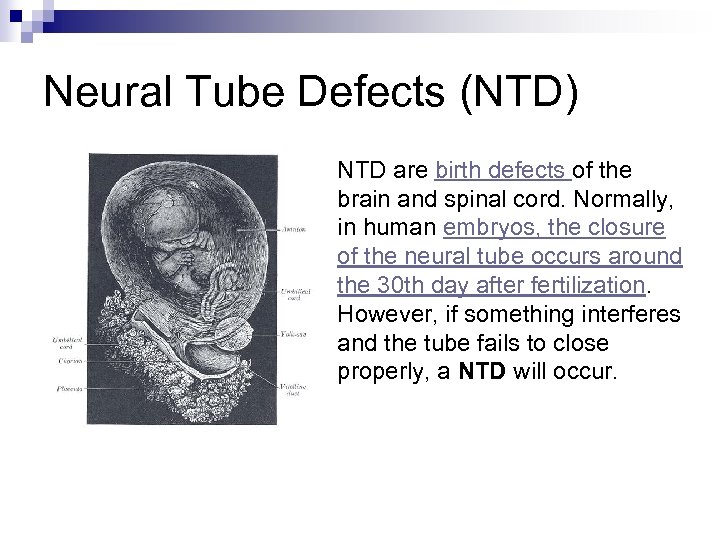 Neural Tube Defects (NTD) ¨ NTD are birth defects of the brain and spinal