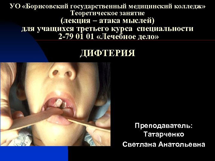 УО «Борисовский государственный медицинский колледж» Теоретическое занятие (лекция – атака мыслей) для учащихся третьего