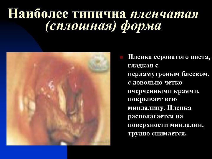 Наиболее типична пленчатая (сплошная) форма n Пленка сероватого цвета, гладкая с перламутровым блеском, с