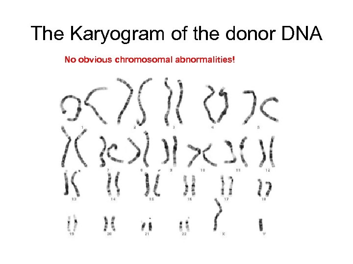 The Karyogram of the donor DNA No obvious chromosomal abnormalities! 
