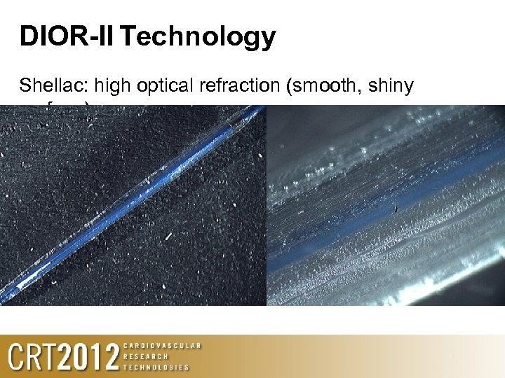 DIOR-II Technology Shellac: high optical refraction (smooth, shiny surface) 