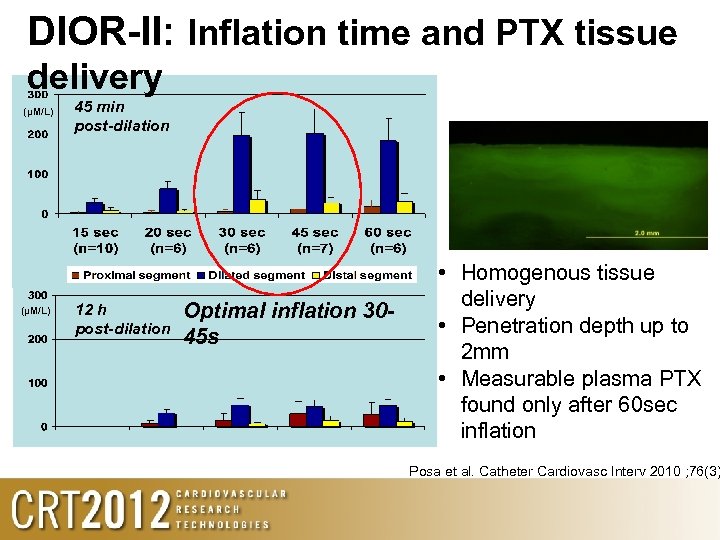 DIOR-II: Inflation time and PTX tissue delivery (µM/L) 45 min post-dilation 12 h post-dilation