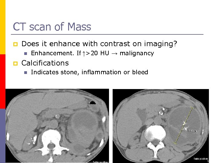 CT scan of Mass p Does it enhance with contrast on imaging? n p
