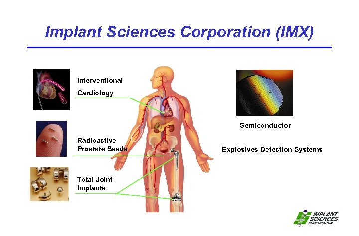 Implant Sciences Corporation (IMX) Interventional Cardiology Semiconductor Radioactive Prostate Seeds Total Joint Implants Explosives