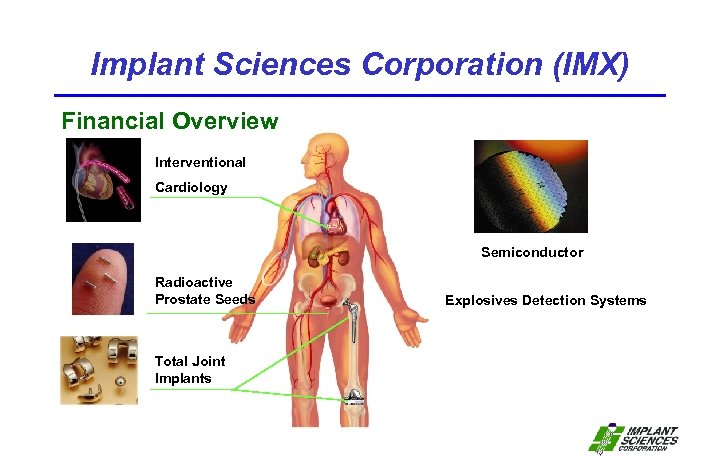 Implant Sciences Corporation (IMX) Financial Overview Interventional Cardiology Semiconductor Radioactive Prostate Seeds Total Joint