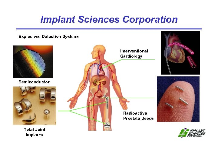 Implant Sciences Corporation Explosives Detection Systems Interventional Cardiology Semiconductor Radioactive Prostate Seeds Total Joint