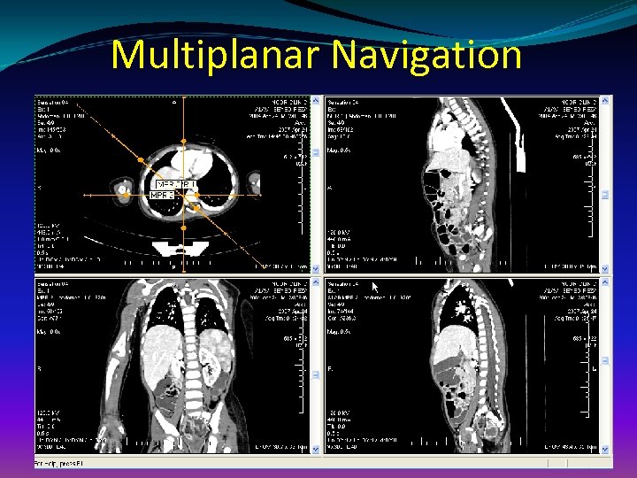 Multiplanar Navigation 