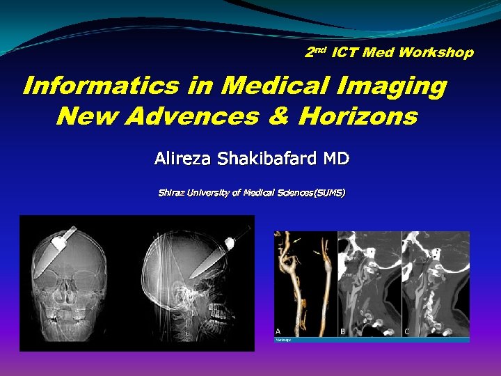 2 nd ICT Med Workshop Informatics in Medical Imaging New Advences & Horizons Alireza