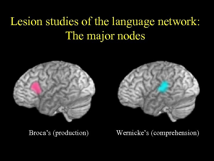 Lesion studies of the language network: The major nodes Broca’s (production) Wernicke’s (comprehension) 