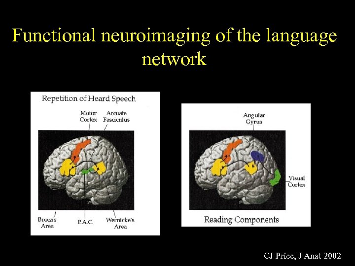 Functional neuroimaging of the language network CJ Price, J Anat 2002 