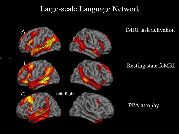 Large-scale Language Network A f. MRI task activation B Resting state fc. MRI C