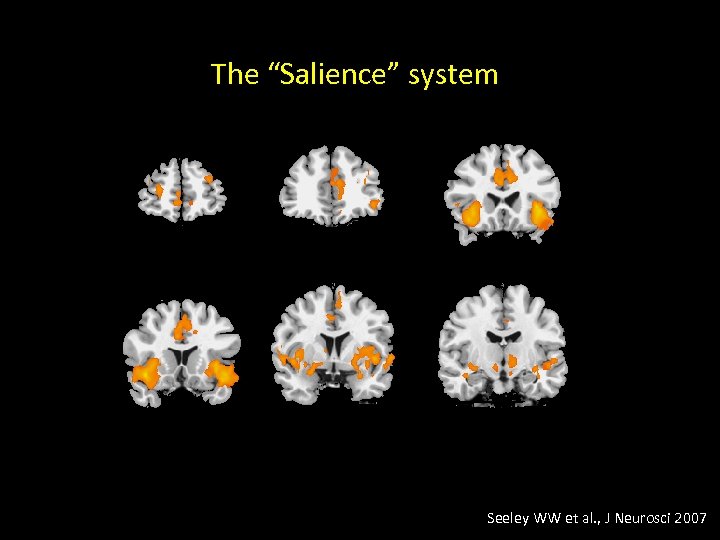 The “Salience” system Seeley WW et al. , J Neurosci 2007 