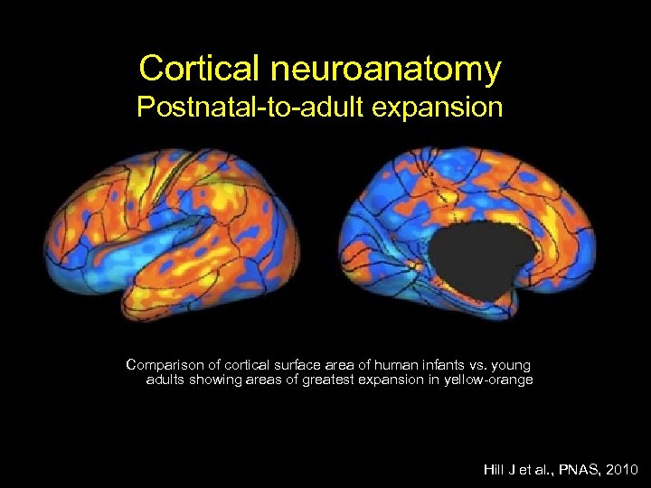 Cortical neuroanatomy Postnatal-to-adult expansion Comparison of cortical surface area of human infants vs. young