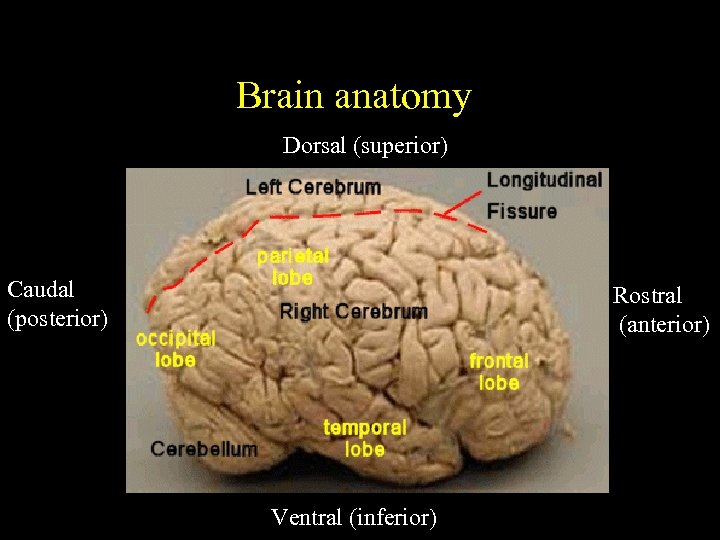 Brain anatomy Dorsal (superior) Caudal (posterior) Rostral (anterior) Ventral (inferior) 