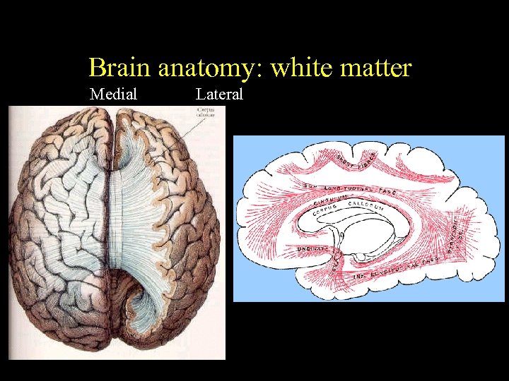 Brain anatomy: white matter Medial Lateral 