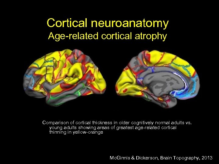 Cortical neuroanatomy Age-related cortical atrophy Comparison of cortical thickness in older cognitively normal adults