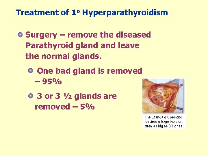 Treatment of 1 o Hyperparathyroidism Surgery – remove the diseased Parathyroid gland leave the