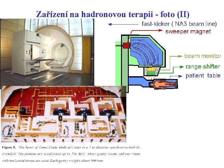 Zařízení na hadronovou terapii - foto (II) schéma gantry 