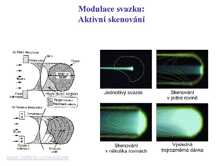 Modulace svazku: Aktivní skenování www. particle. cz/medicine 