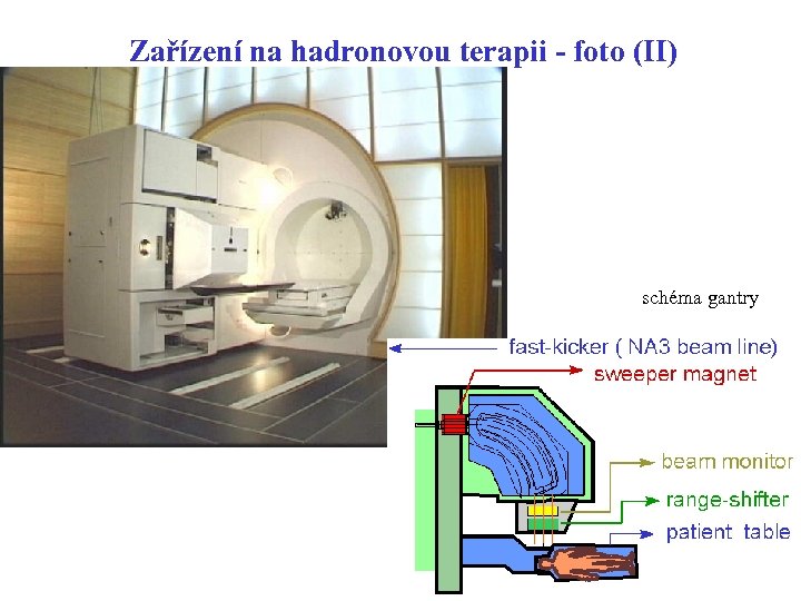 Zařízení na hadronovou terapii - foto (II) schéma gantry 