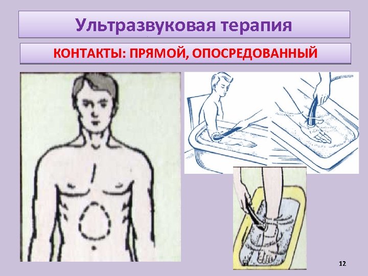 Ультразвуковая терапия КОНТАКТЫ: ПРЯМОЙ, ОПОСРЕДОВАННЫЙ 12 