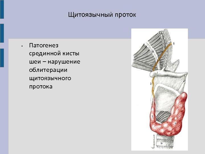 Щитоязычный проток • Патогенез срединной кисты шеи – нарушение облитерации щитоязычного протока 