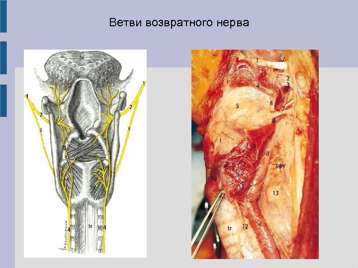 Ветви возвратного нерва 