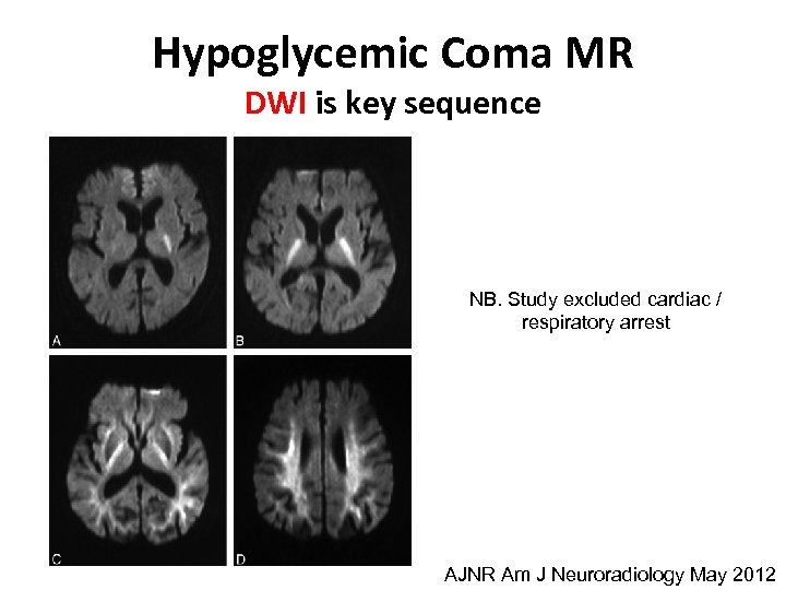 Hypoglycemic Coma MR DWI is key sequence NB. Study excluded cardiac / respiratory arrest