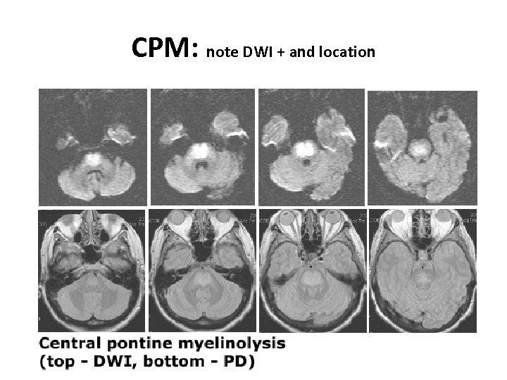 CPM: note DWI + and location 