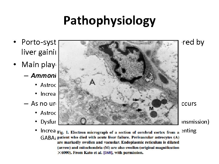 Pathophysiology • Porto-systemic shunt with toxins normally filtered by liver gaining direct access to