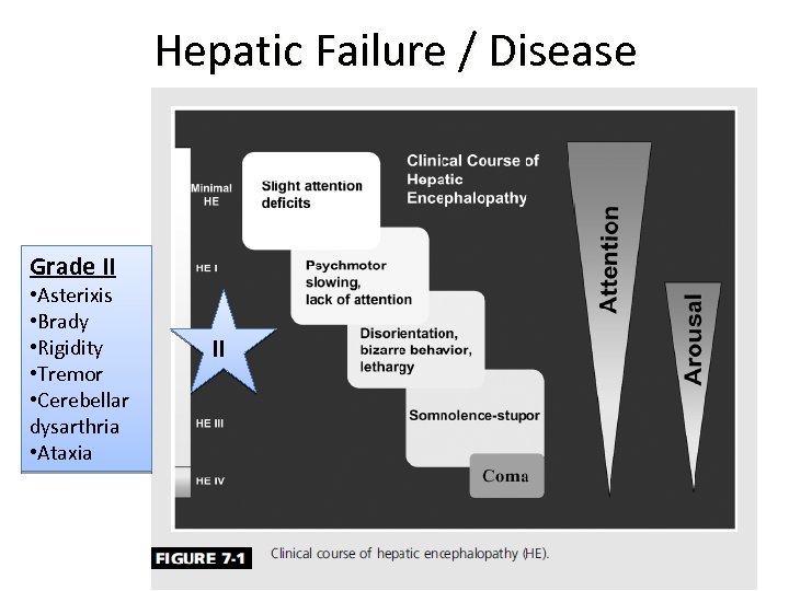 Hepatic Failure / Disease Grade II • Asterixis • Brady • Rigidity • Tremor