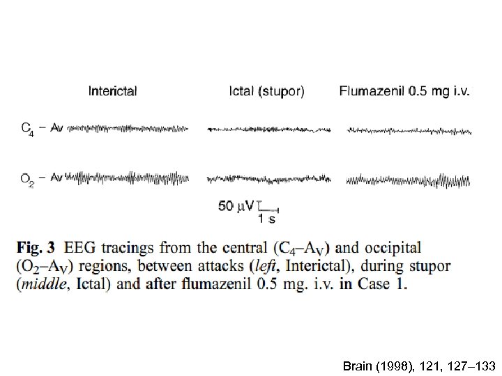 Brain (1998), 121, 127– 133 
