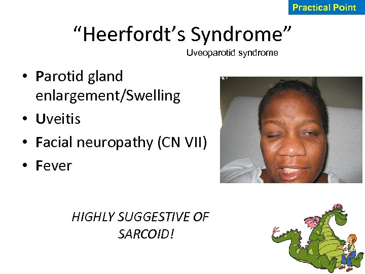 Practical Point “Heerfordt’s Syndrome” Heerfordt’s Syndrome Uveoparotid syndrome • Parotid gland enlargement/Swelling • Uveitis