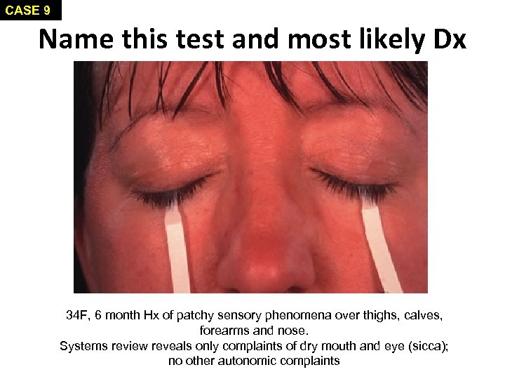 CASE 9 Name this test and most likely Dx 34 F, 6 month Hx