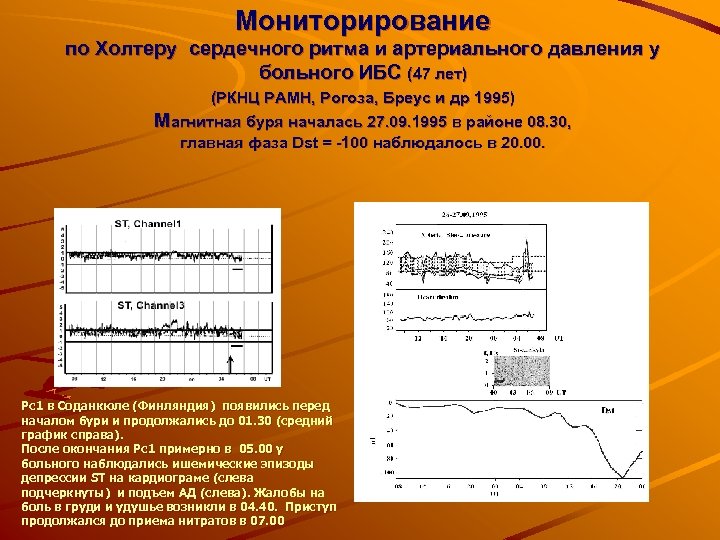 Мониторирование по Холтеру сердечного ритма и артериального давления у больного ИБС (47 лет) (РКНЦ