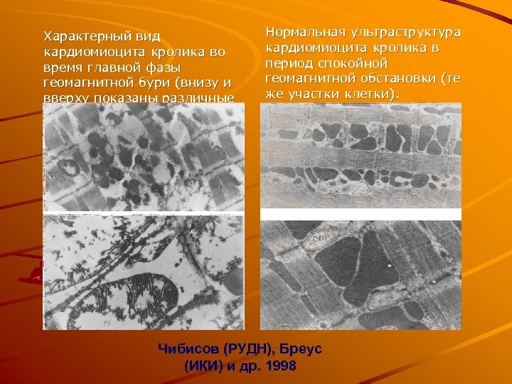 Характерный вид кардиомиоцита кролика во время главной фазы геомагнитной бури (внизу и вверху показаны