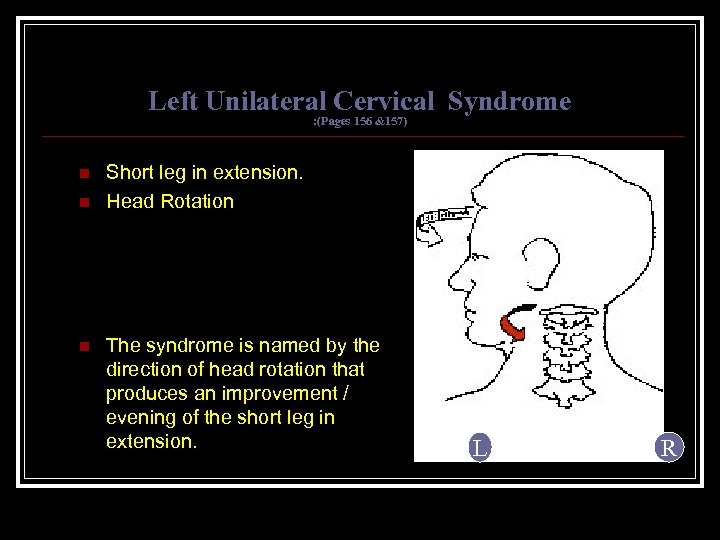 Left Unilateral Cervical Syndrome : (Pages 156 &157) n n n Short leg in
