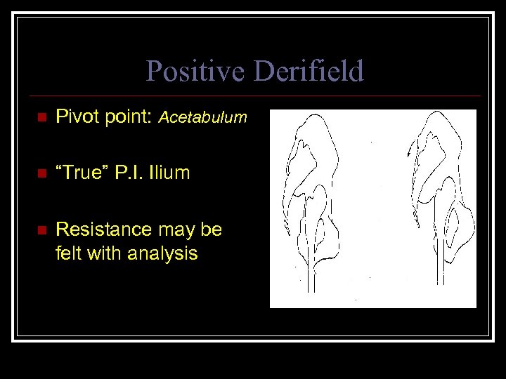 Positive Derifield n Pivot point: Acetabulum n “True” P. I. Ilium n Resistance may